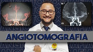 Angiotomografia e perfusão cerebral passo a passo [upl. by Nosaes]