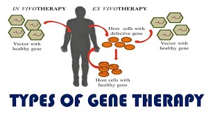 Types of Gene therapy [upl. by Accem]