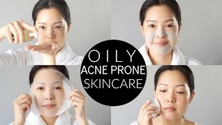 Basic Oily amp AcneProne Skincare Routine and Essentials [upl. by Myca]