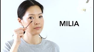 Milia  How to Treat amp Prevent  Best Eye Products [upl. by Elane]