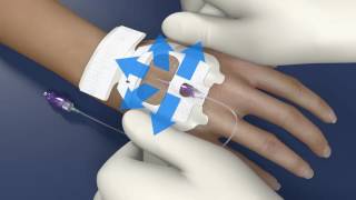 Tegaderm™ IV Advanced Dressing 1683 for PIV Application Video [upl. by Etteoj]