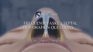 Septal Perforation Frequently Asked Questions by Dr Jason S Hamilton [upl. by Ahteres]