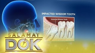 Salamat Dok Expert talks about wisdom tooth [upl. by Abernon799]