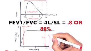 Understanding Spirometry  Normal Obstructive vs Restrictive [upl. by Gayleen966]