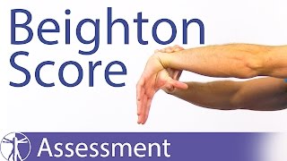 The Beighton Score  Generalized Joint Hypermobility Laxity [upl. by Felix]