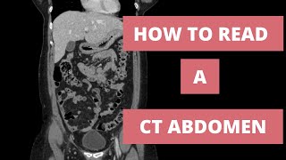 How to read a CT Abdomen for Med students and Residents  Part 1 [upl. by Layman]