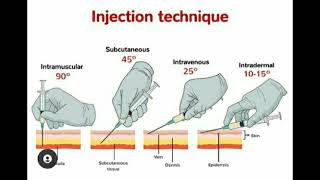 Injection Techniques quotIntermuscular Subcutaneous Intravenous Intradermalquot [upl. by Hallimaj]