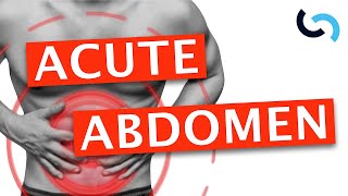 Acute Abdomen  Diagnosis and Management [upl. by Yeldah]