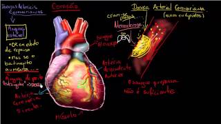 O que é Doença arterial coronariana [upl. by Wilsey211]